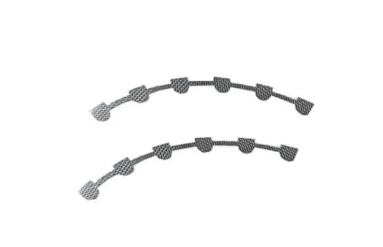 Lingual Retainer